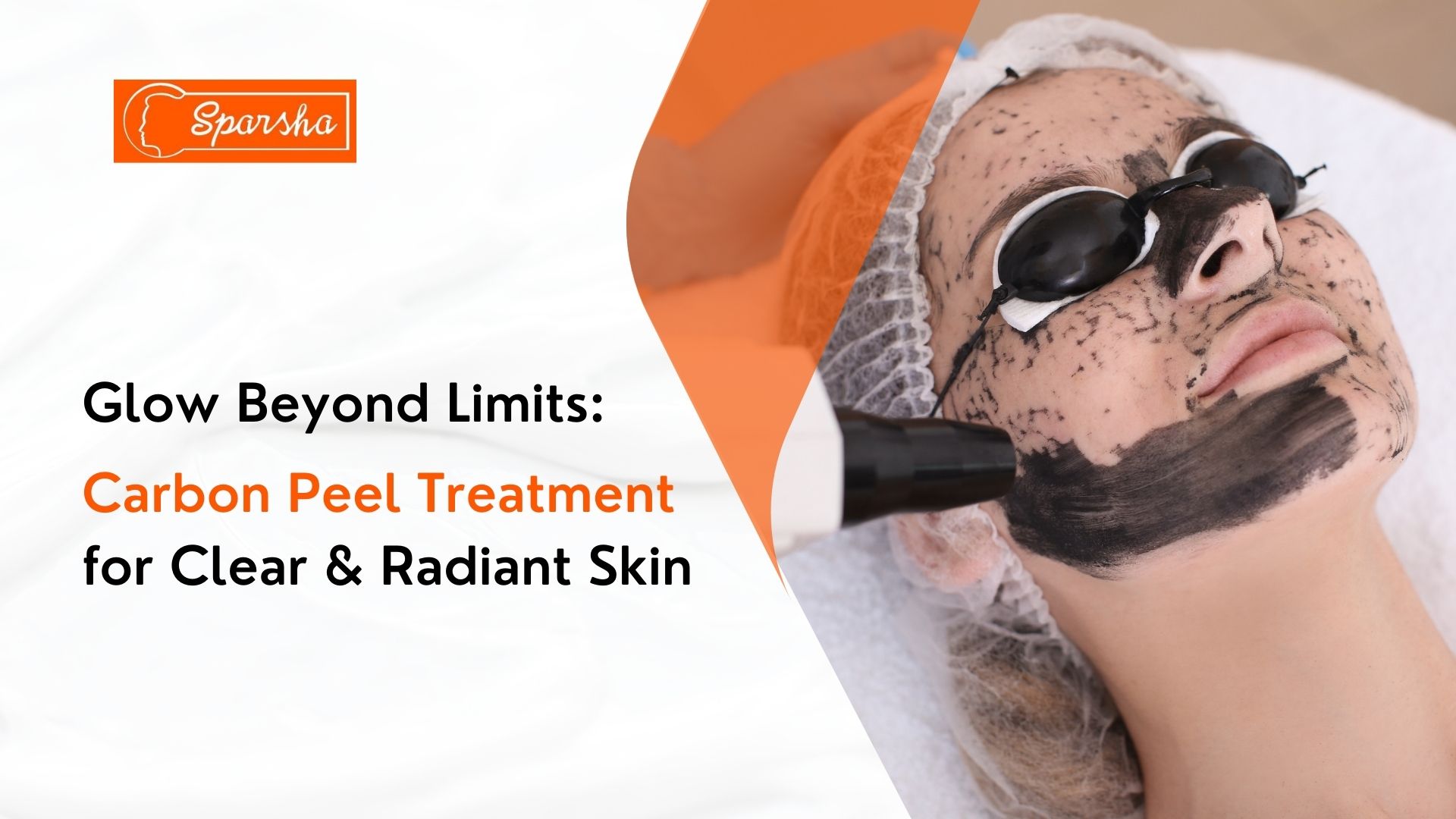 Carbon Laser Peel treatment in RR Nagar | Dr. M.A. Sandeep