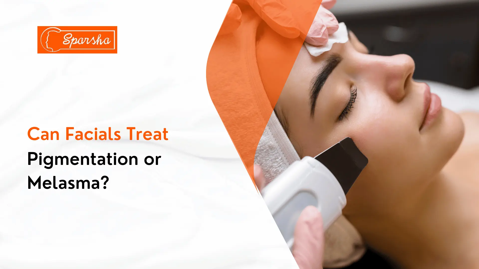 Best Carbon Laser Peel Treatment in RR Nagar Bangalore