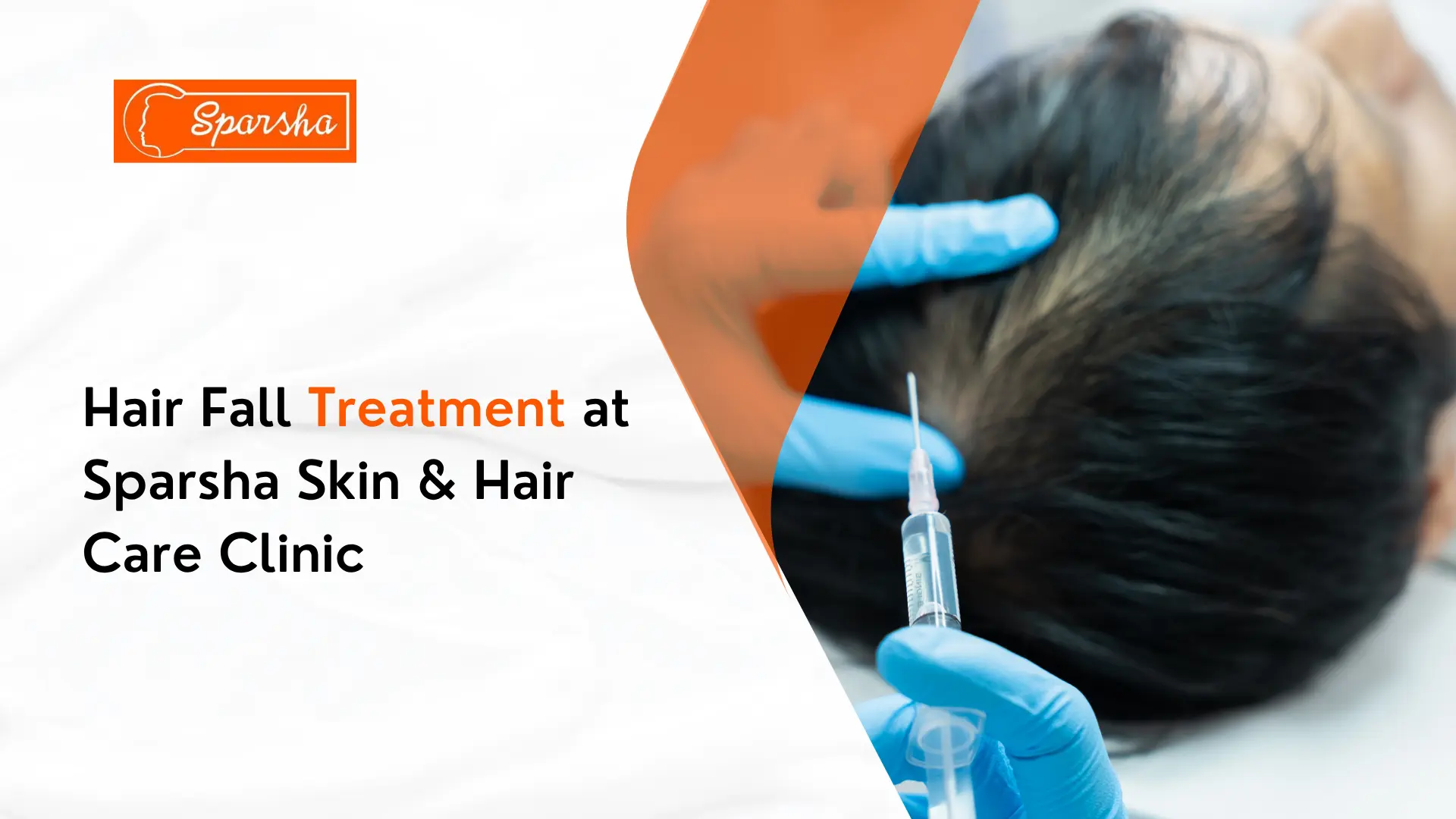 Best Hair Loss Treatment in Bangalore