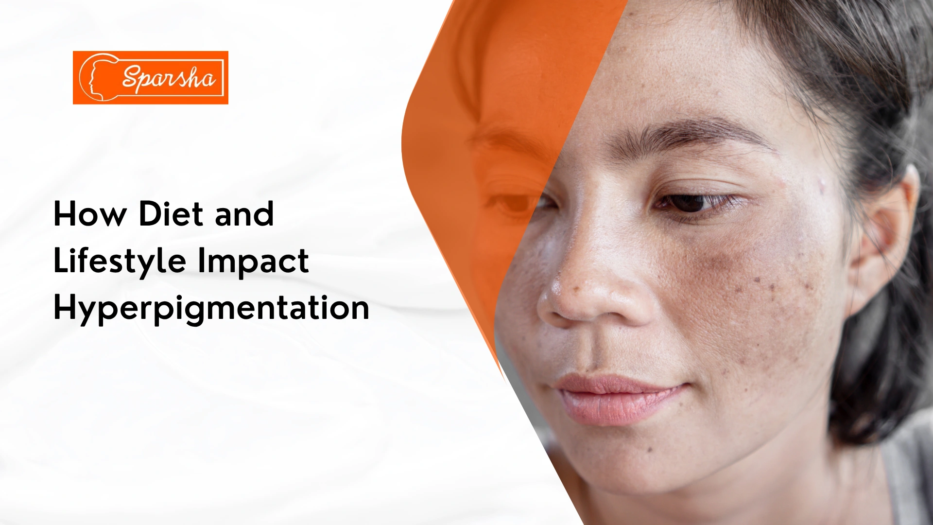 Best Dermatologist in RR Nagar