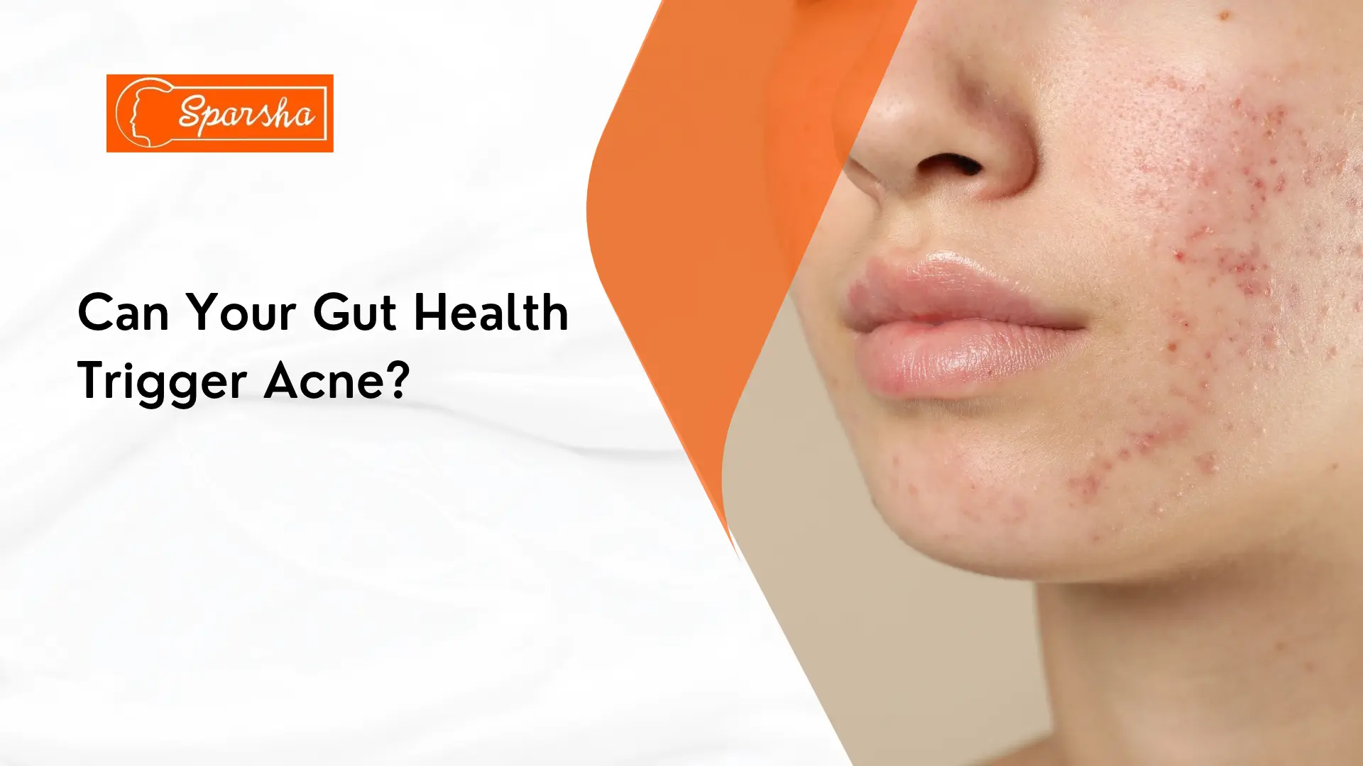 Hydrafacial in RR Nagar